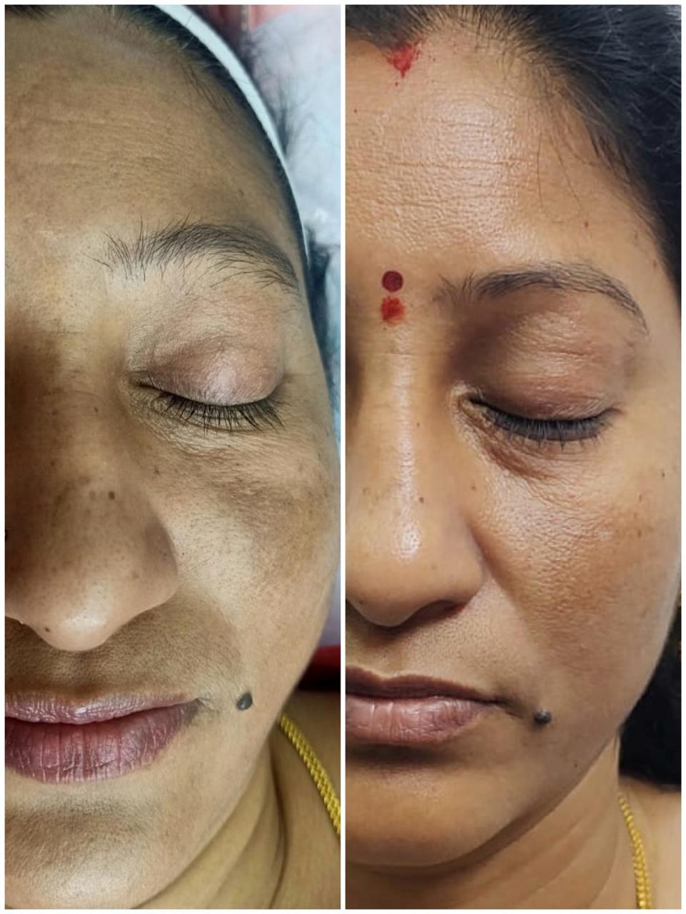 Anti-Ageing Therapy